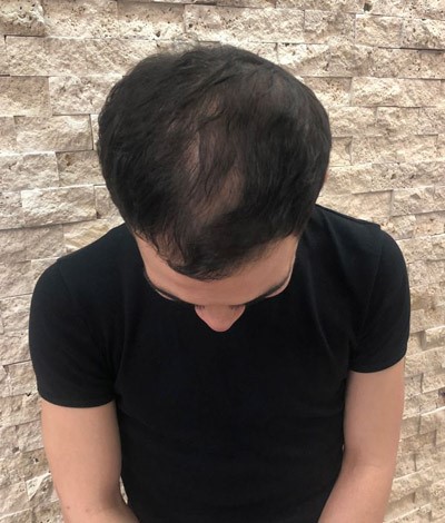 29