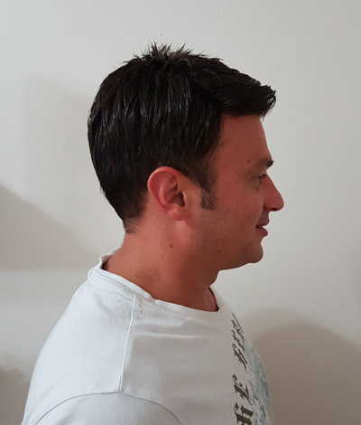 25